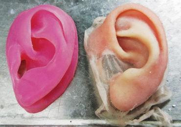 3D printing prosthetics