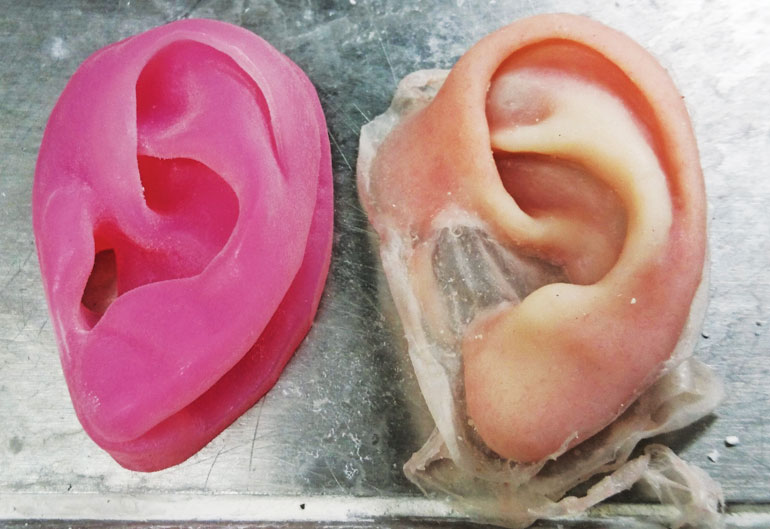 3D printing prosthetics