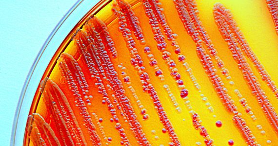 antibiotic resistant bacteria