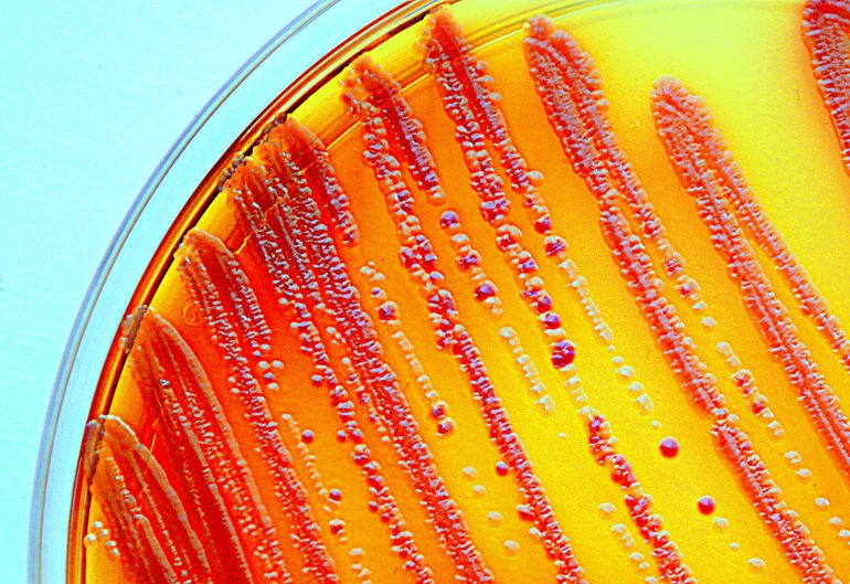 antibiotic resistant bacteria